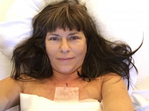 mastectomy selfie